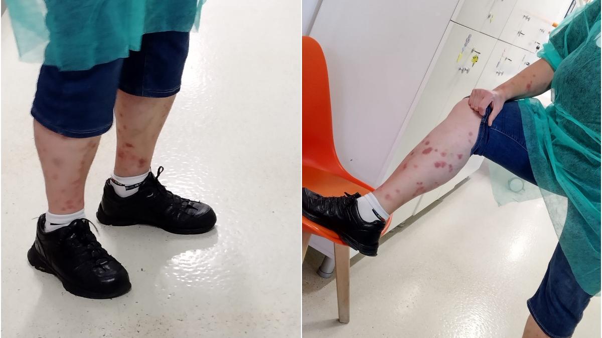 pleosnite hotel baile felix