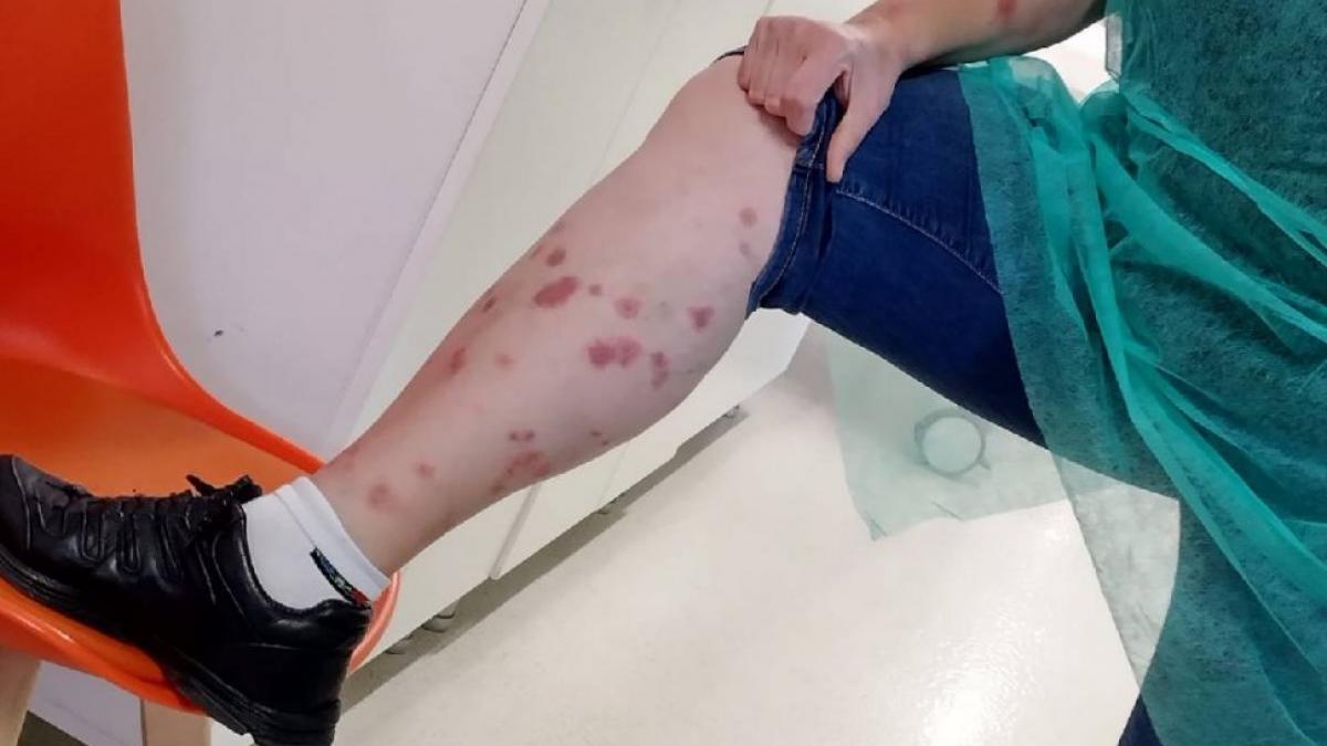 inspectori hotel statiune balneara turista ciupita de plosnite