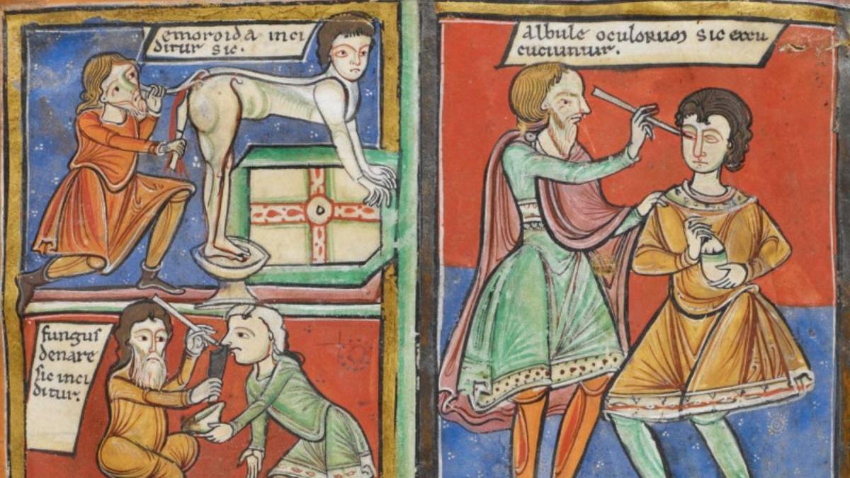 leacuri naturiste evul mediu cataracta