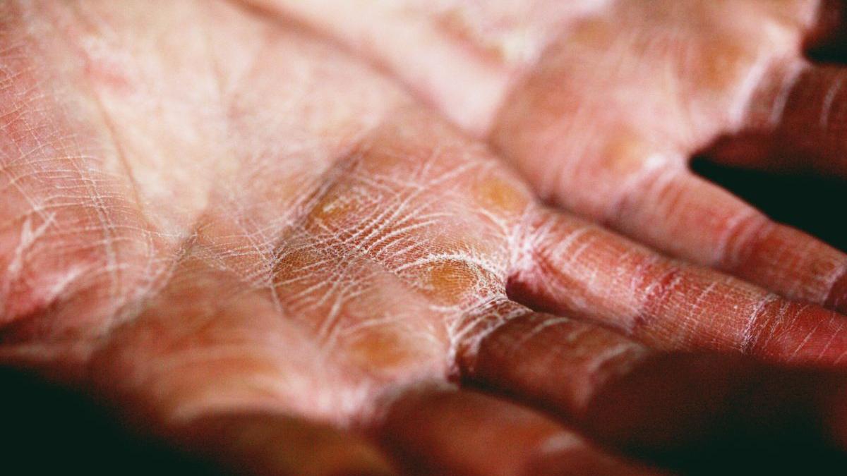 L’erba che aiuta a curare le mani screpolate.  Costa 5 lei e funziona in 15 minuti