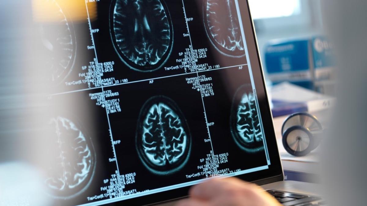 eliberare serotonina diminuata creier persoane depresie descoperire psihiatri