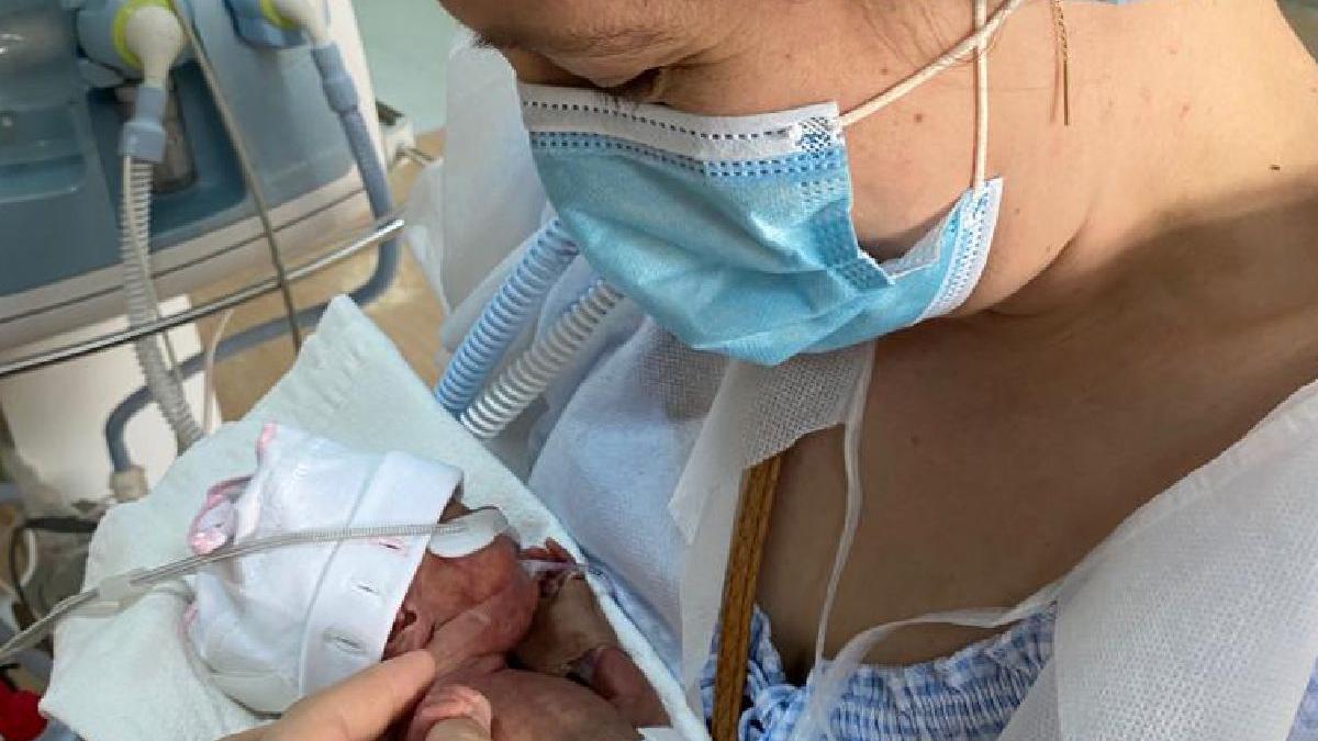 copil prematur spitalul universitar 500 de grame