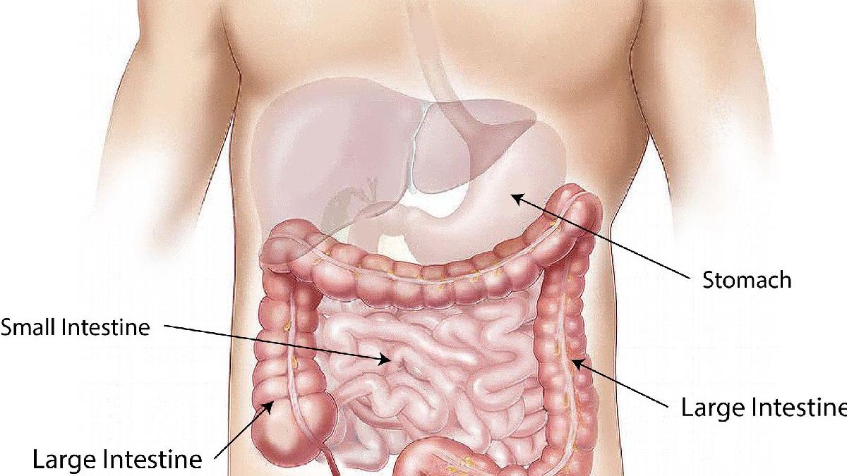 copii enterocolita gradinite satu mare