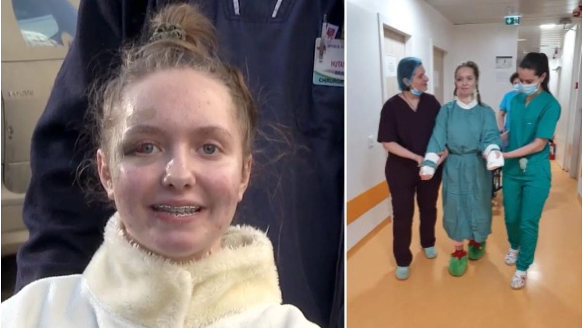 primele marturii alexia adolescenta brate replantate chirurgi iasi