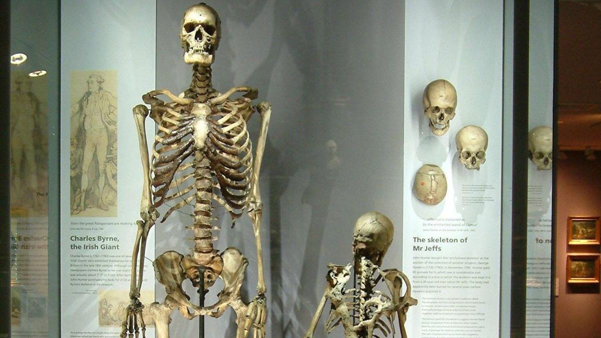 uriasul irlandez temere exponat dupa moarte