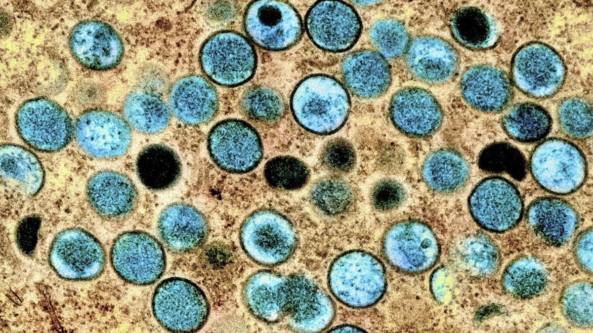 moartea invizibila trecut incalzirea globala virusuri letale sol arctica dezghetat mii de ani