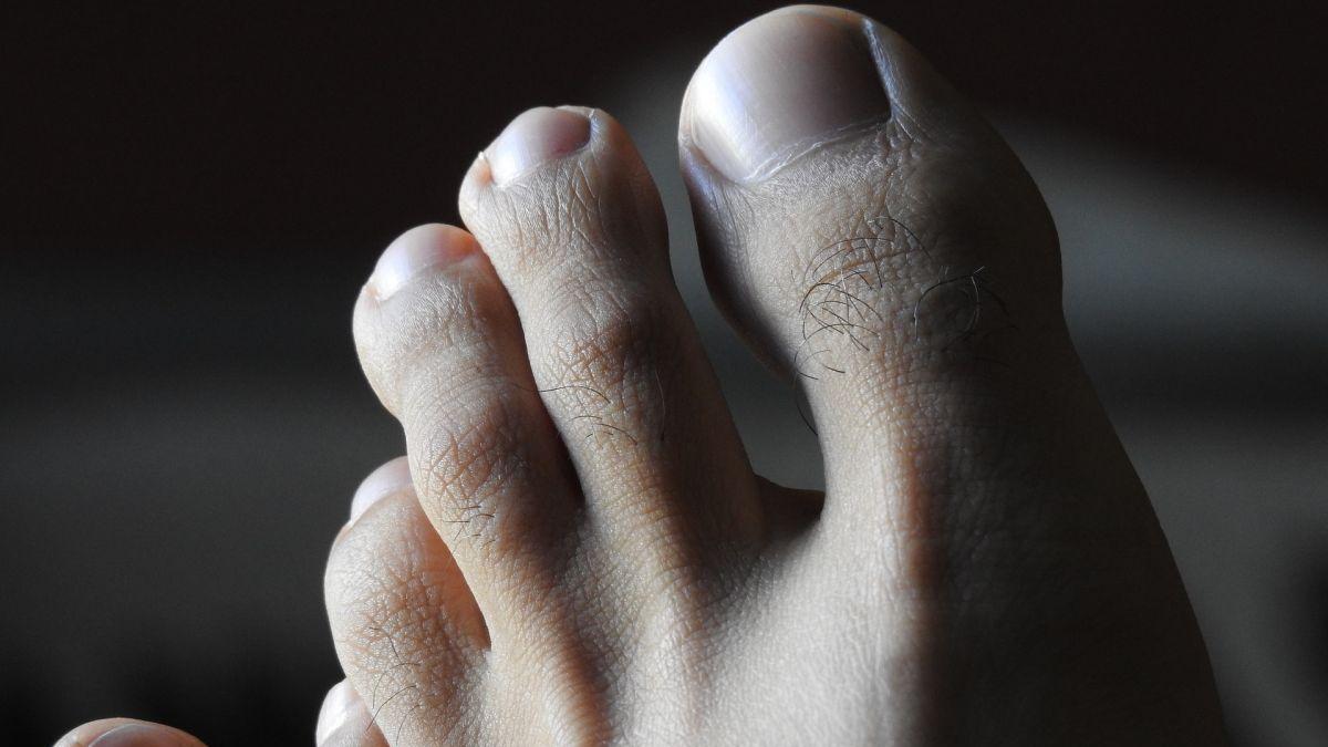 hotel oaspete manager degete picioare