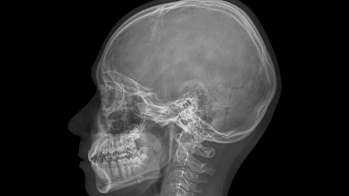 barbat glont creier supravietuit fata stranie pacientul m