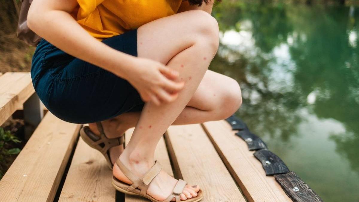 obiceiuri atrag tantarii metode eficiente tine distanta vara