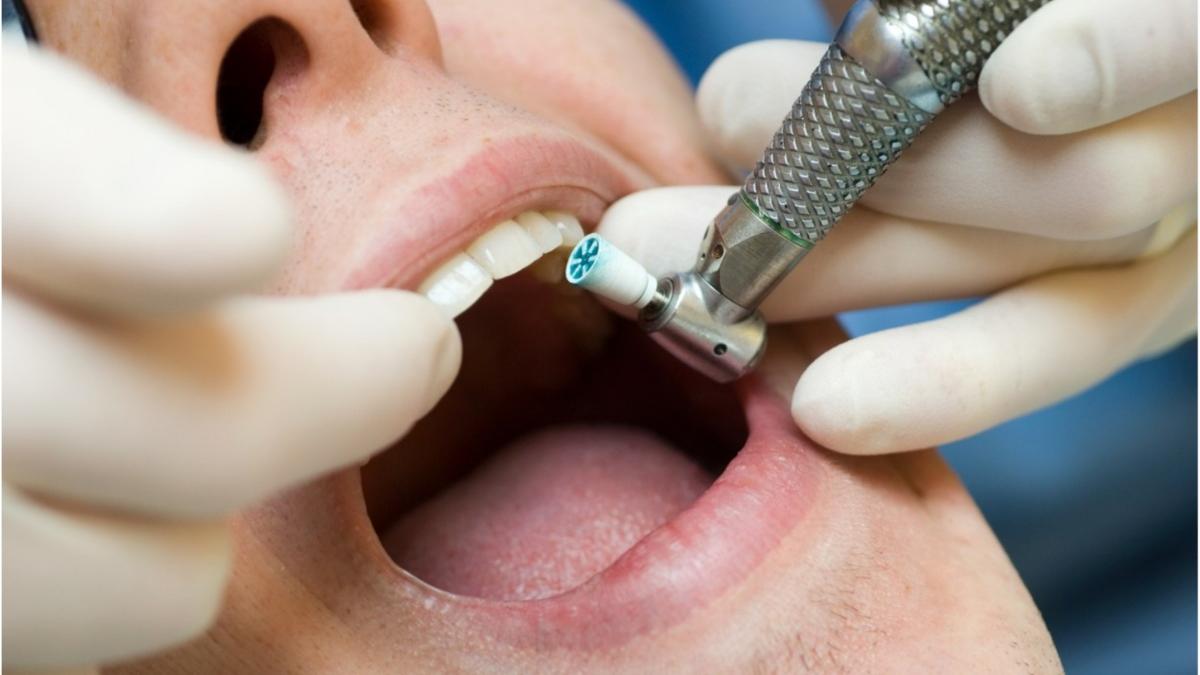 servicii stomatologice gratuite proceduri decontate de casa de asigurari