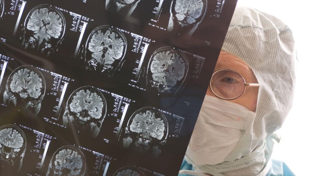 varsta creier uman continua dezvoltare se maturizeaza complet mult dupa 18 ani