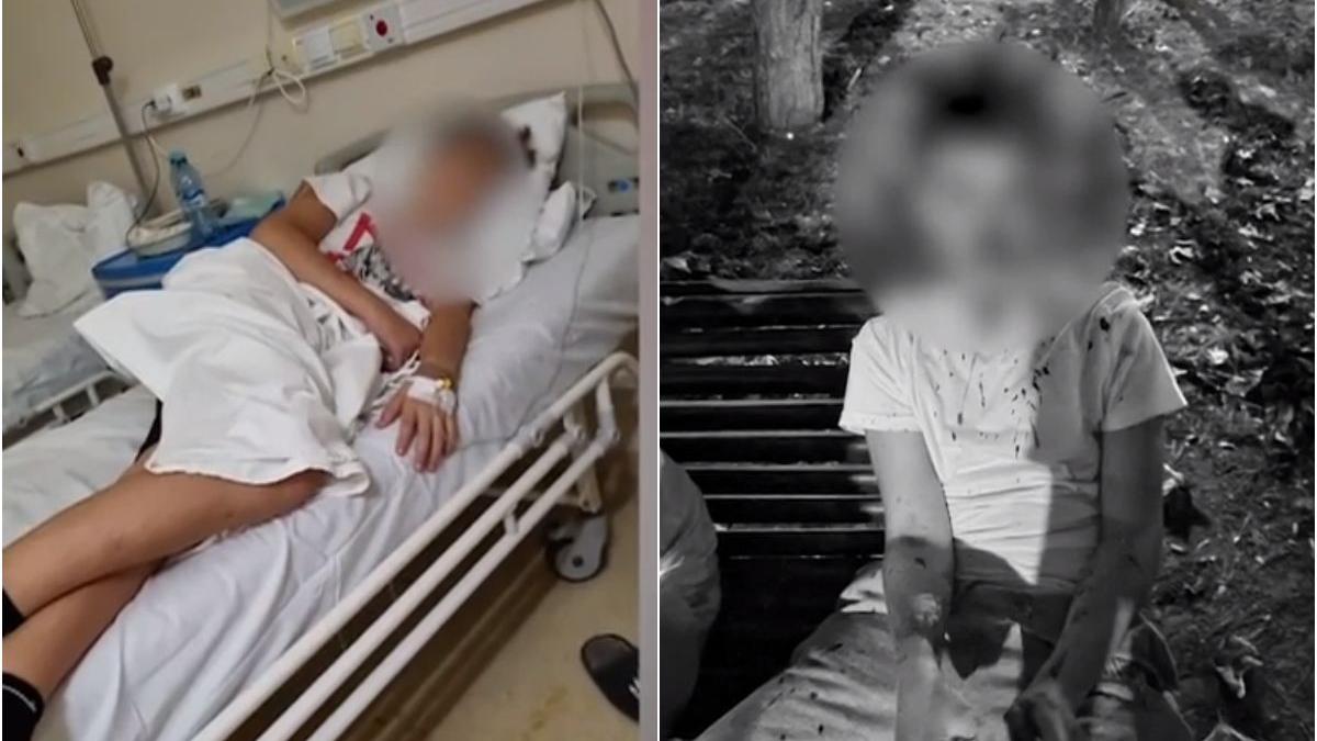 copil desfigurat bataie parc bucuresti