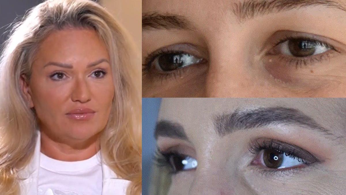 blefaroplastie superioara inferioara cand putem apela la aceasta interventie blefaroplastie superioara inferioara cand putem apela la aceasta interventie