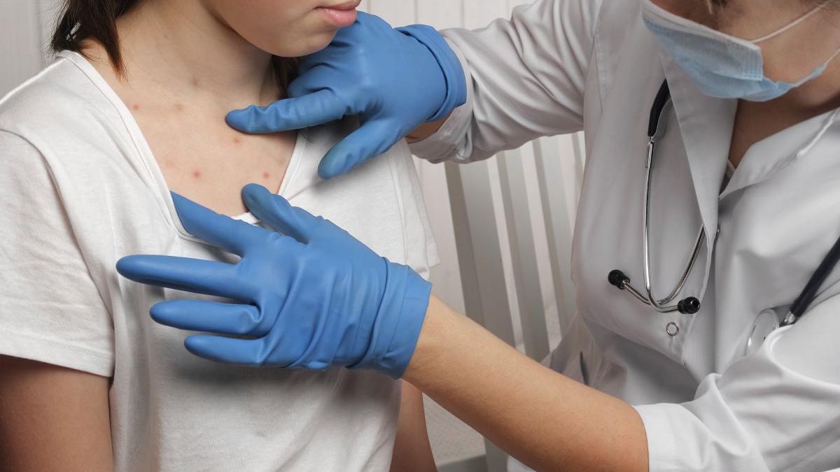 lista judete afectate epidemie rujeola