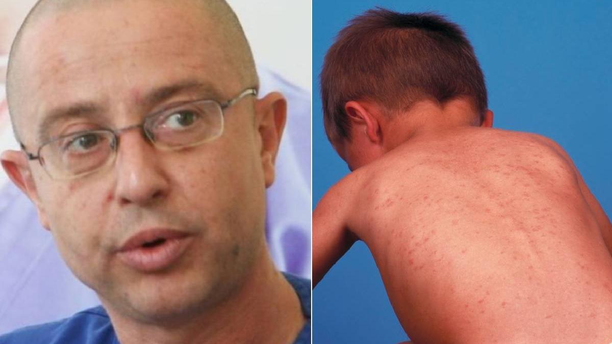 tudor ciuhodaru epidemie rujeola romania