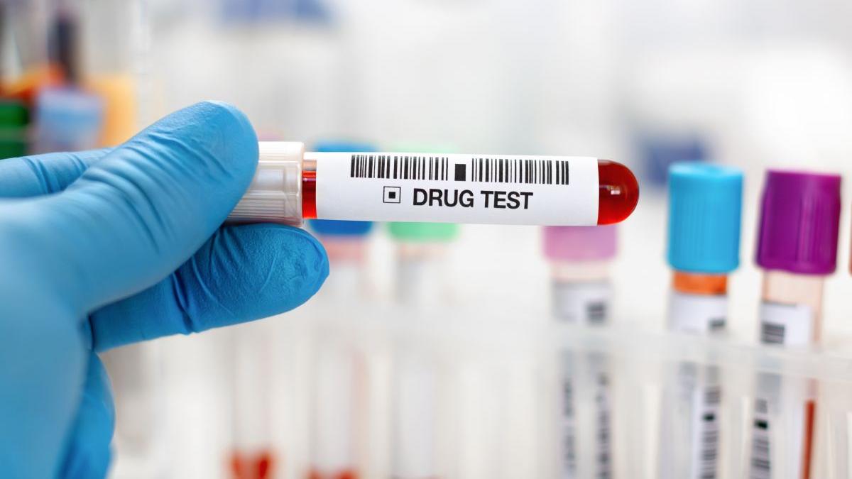 aparat drugtest rezultate fals pozitive soferi