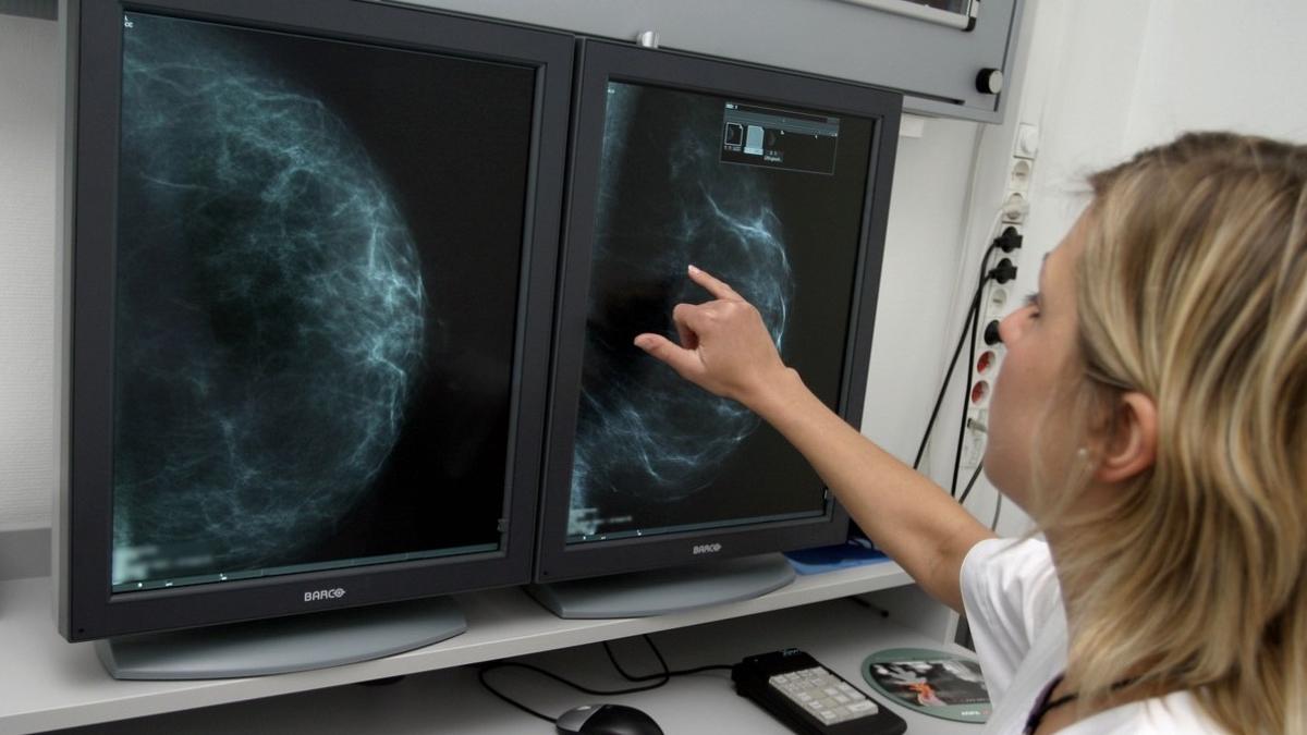 tratamente noi in romania pentru femeile cu cancer la san