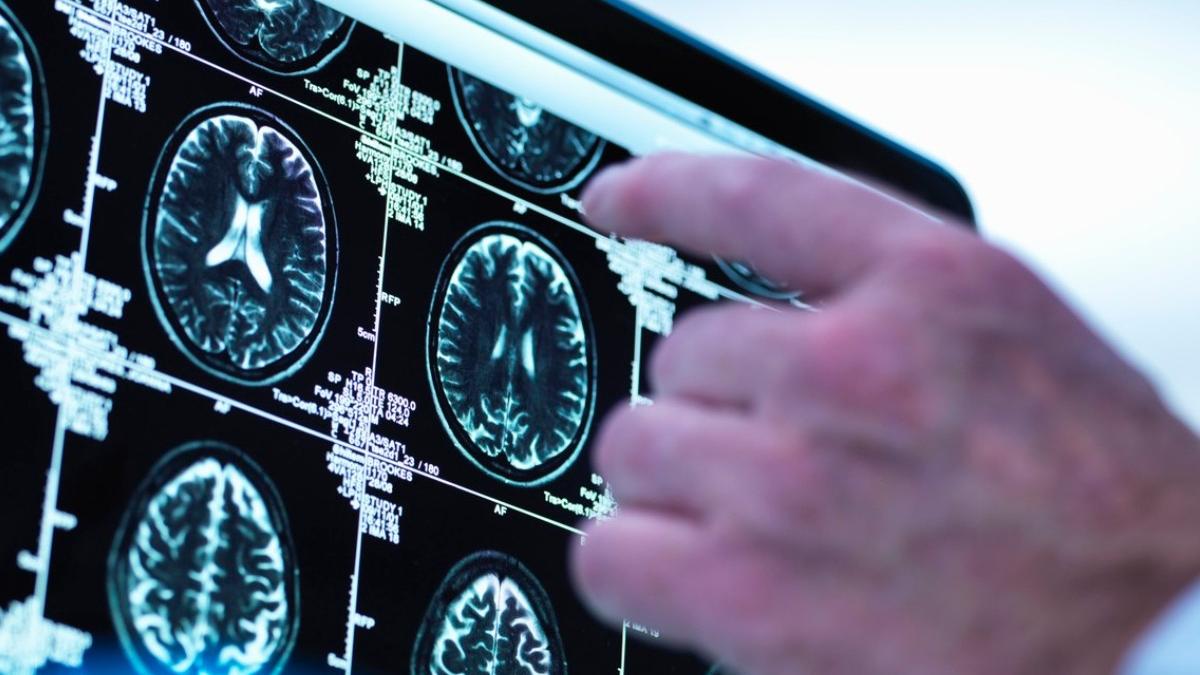 medic neurochirurg diferenta ct rmn rezultate control medical