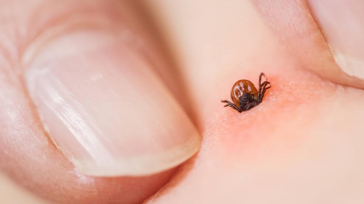 ce faci daca ai fost muscat de capusa