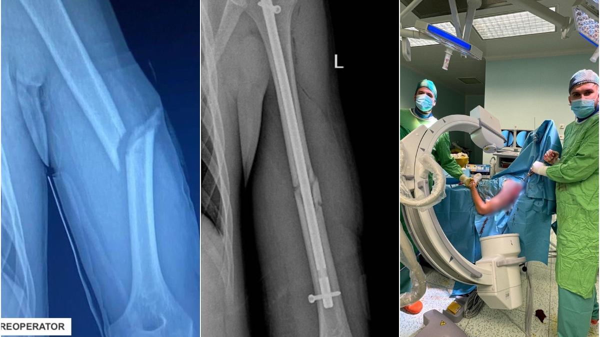 operatie premiera spital judetean oradea tanar vitima accident rutier