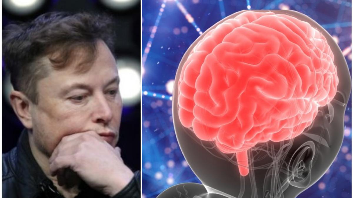 Eşec pentru Elon Musk. Primul cip implantat în creierul unui pacient a suferit un incident neaşteptat