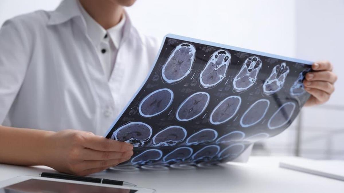 tot mai multi tineri sunt diagnosticati cu scleroza multipla sau parkinson