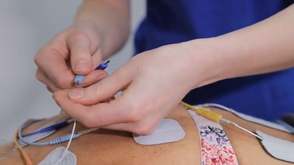 procedura care ajuta la eliminarea durerii in urma unui traumatism