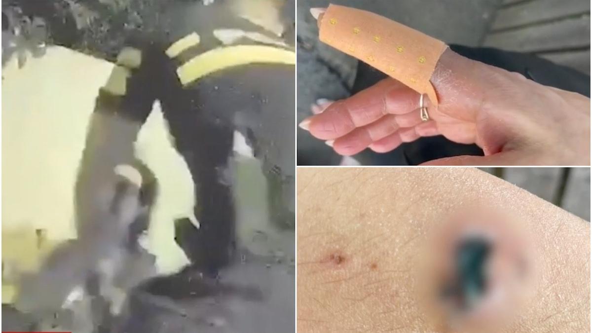 o tanara de 29 de ani arestata dupa ce si a muscat fetita vecinii si pe politisti care au intervenit