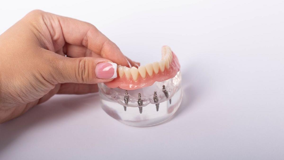 solutii moderne de restaurare a danturii