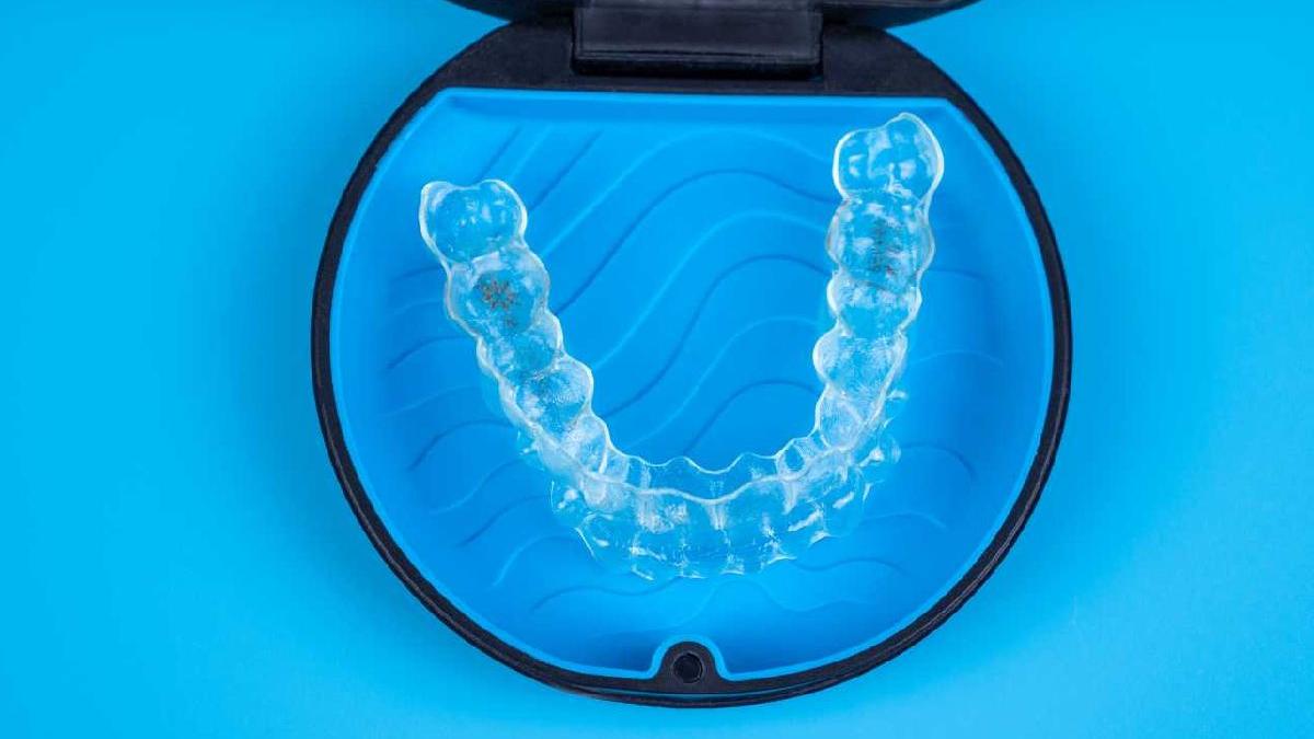 care este varsta minima si maxima pentru aparat dentar iata ce spun specialistii