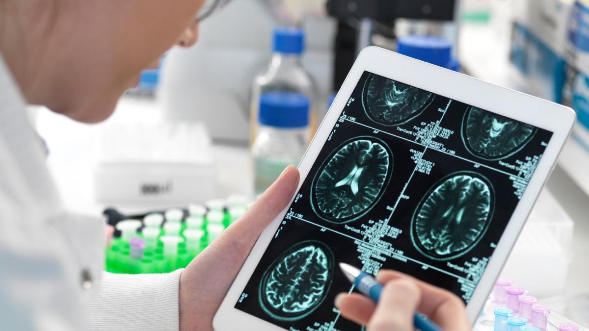 primul tratament pentru boala alzheimer a fost aprobat de autoritatile medicale din marea britanie