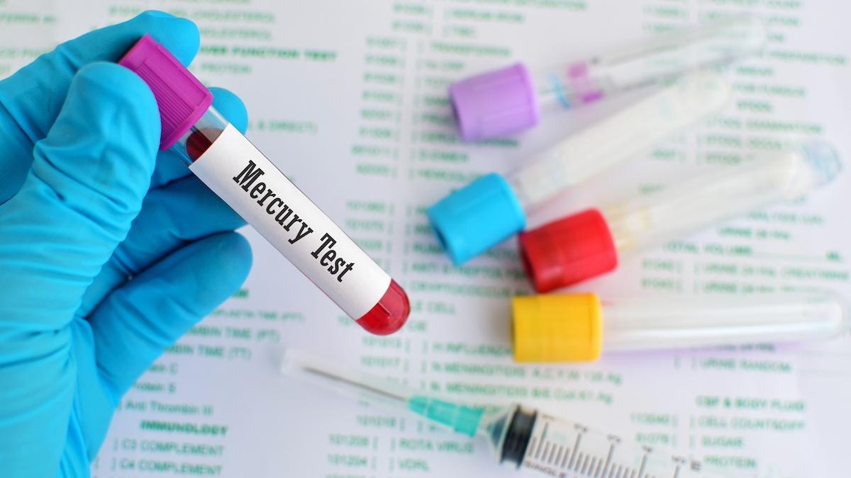 un procuror sef acuza ca a fost otravit cu mercur acesta sustine ca au fost platiti bani grei pentru executarea sa