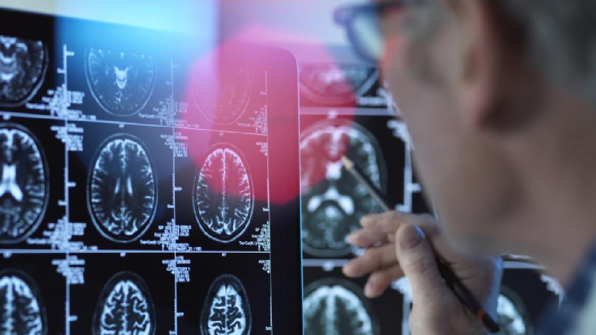 dementa poate fi prevenita arata un studiu ce trebuie sa faci in functie de varsta ca sa nu ajungi la alzheimer