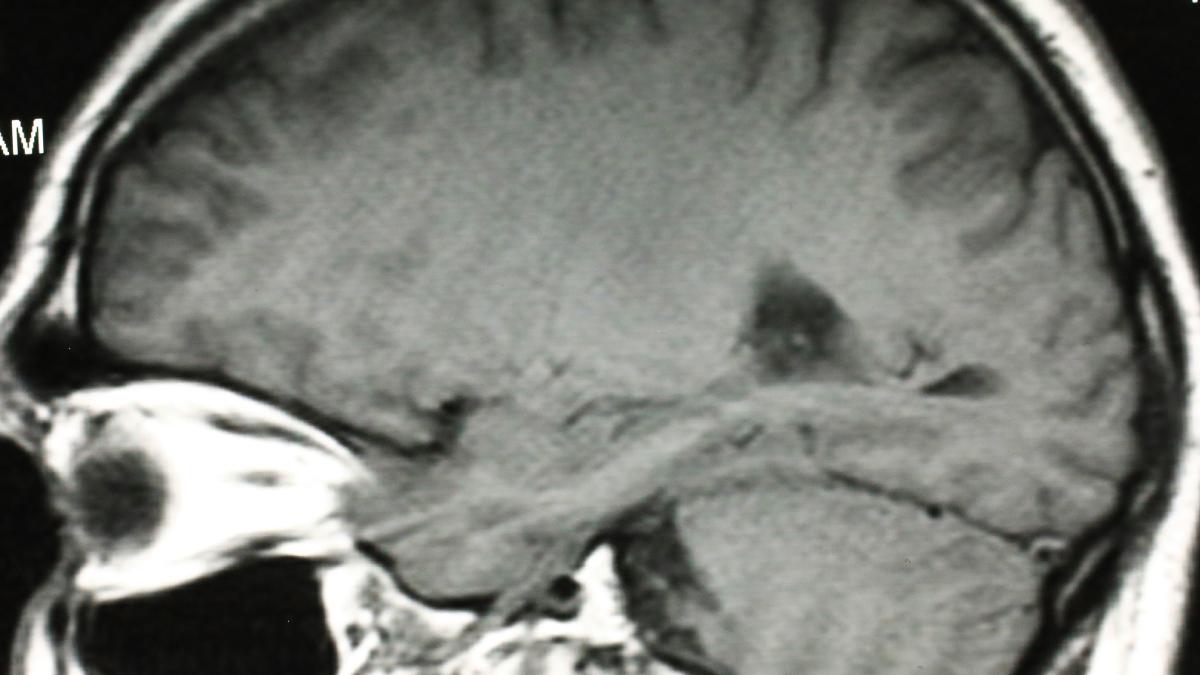 arheologii au gasit cocaina in creiere mumificate ale unor italieni drogul a ajuns in europa cu 200 de ani mai devreme decat se credea