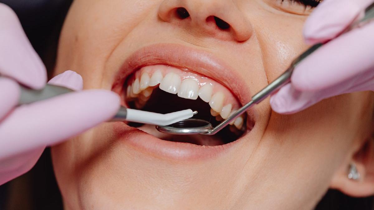 cum sa ne protejam zambetul pe termen lung