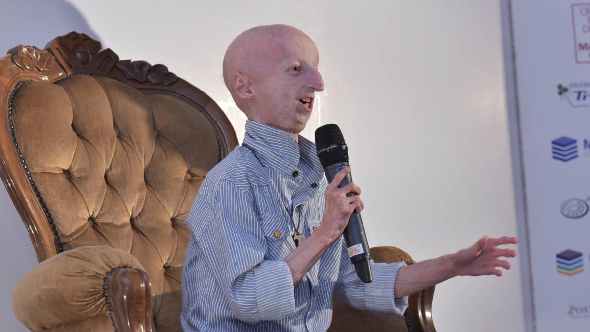 sammy basso om de stiinta si simbol al luptei impotriva progeriei boala de care suferea a murit la 28 de ani