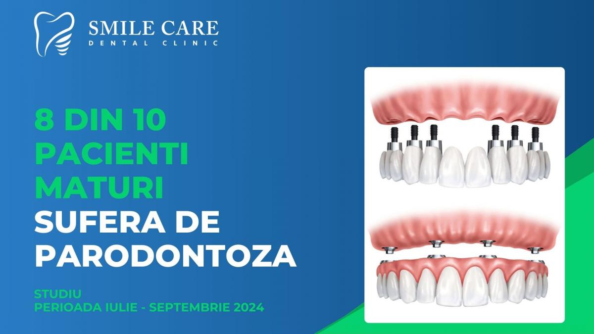 parodontoza avansata un fenomen raspandit printre pacientii maturi