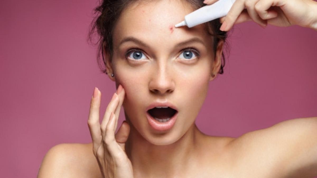 cele mai frecvente greseli in ingrijirea tenului acneic