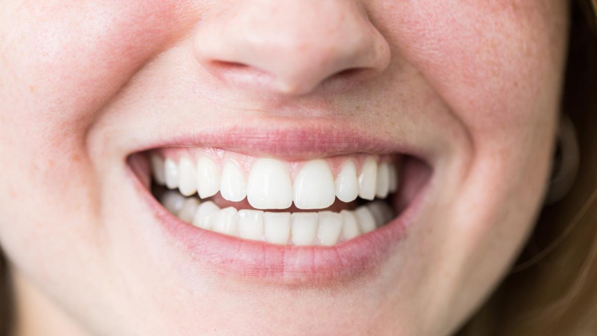 cum afecteaza fumatul succesul unui implant dentar