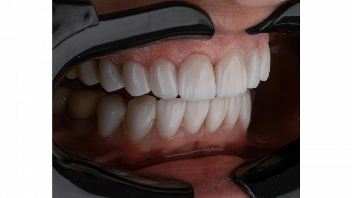 de ce sa alegi delta clinic dent pentru sanatatea si frumusetea zambetului tau