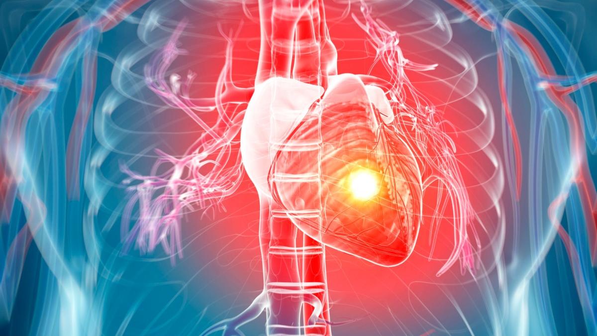 oamenii de stiinta au dezvoltat un plasture pentru inima care ar putea ajuta milioane de pacienti cu insuficienta cardiaca