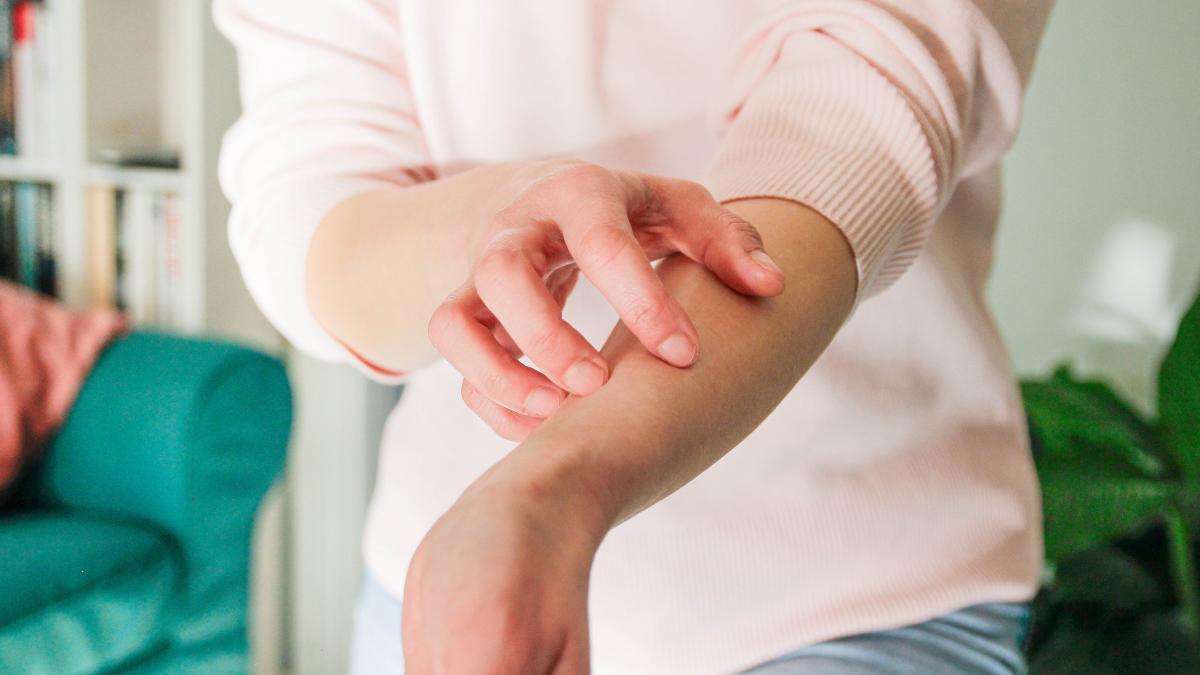 ce boli ascunde mancarimea de piele dr safta atentie putem avea si cancer