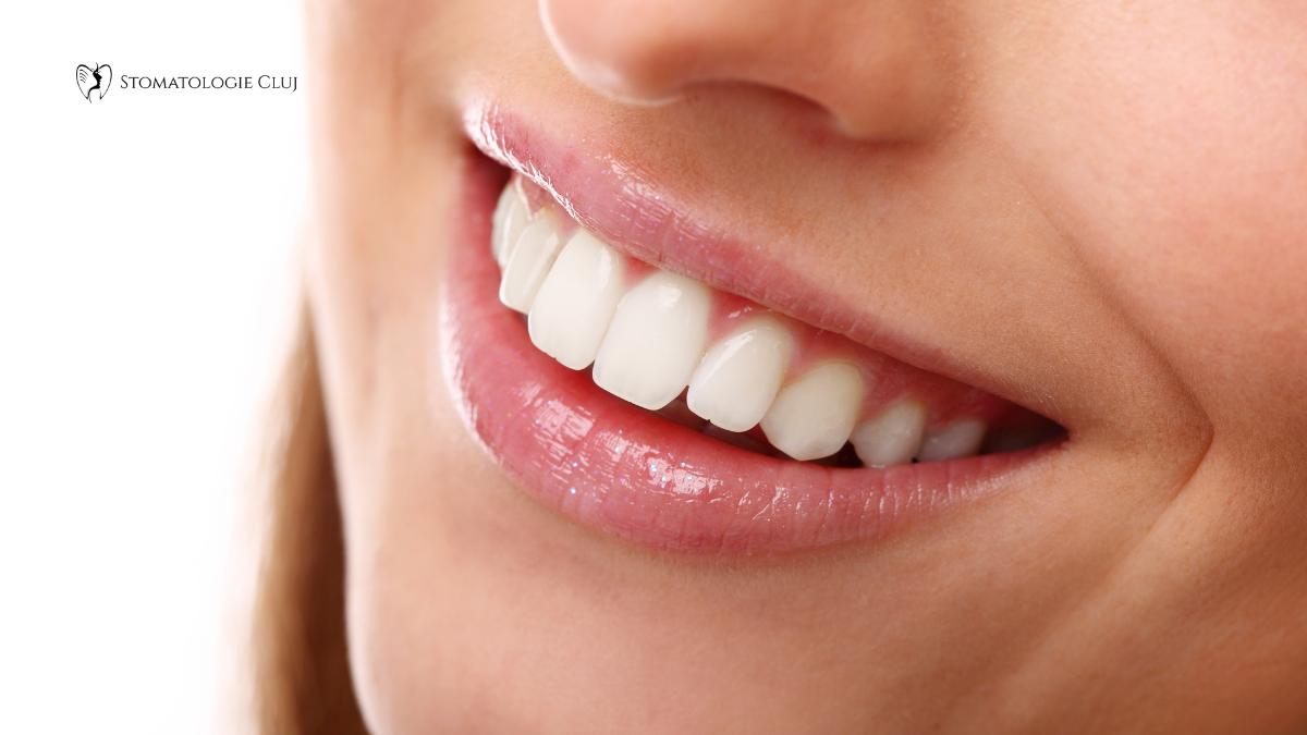 albirea dintilor acasa sau la dentist