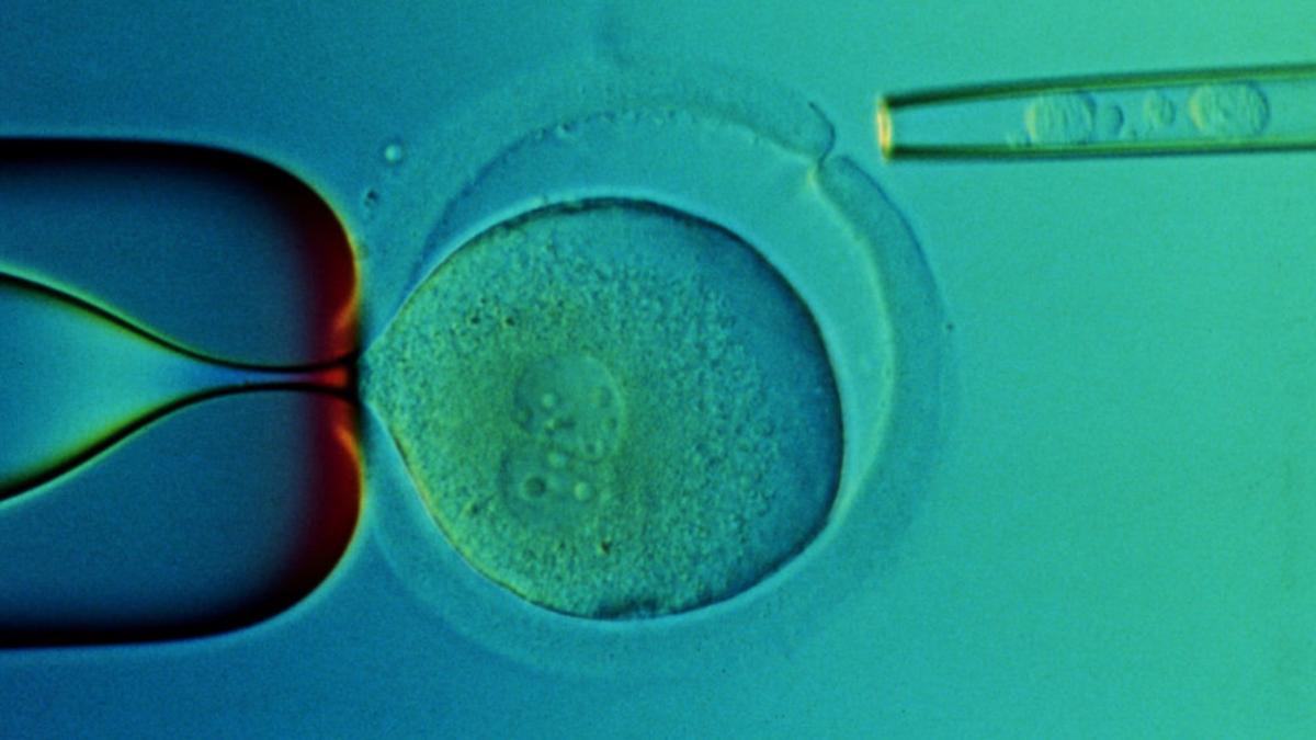 transplant celule stem