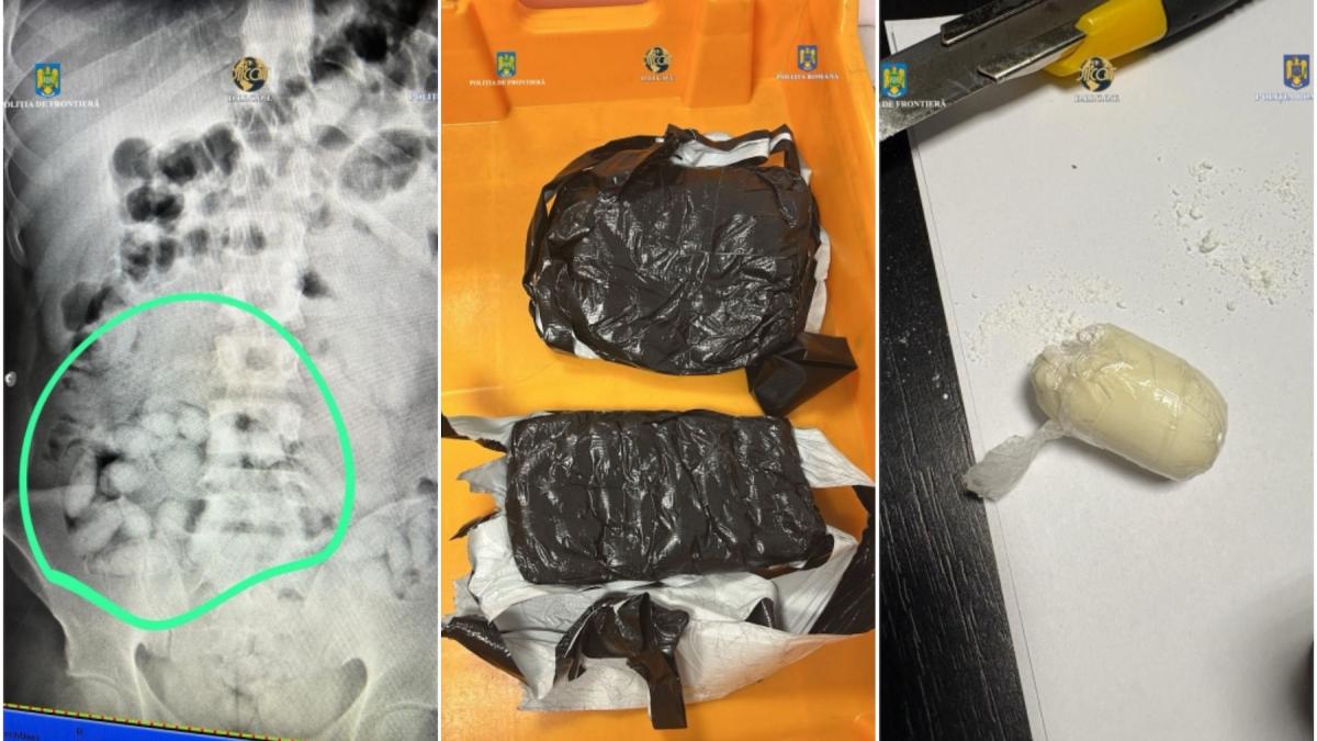 un brazilian a fost prins pe aeroportul otopeni cu pachete cu droguri in stomac