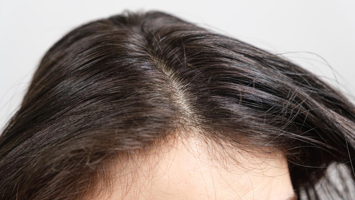 care este cel mai mare dusman al parului sanatos nu este nici vopseaua nici placa