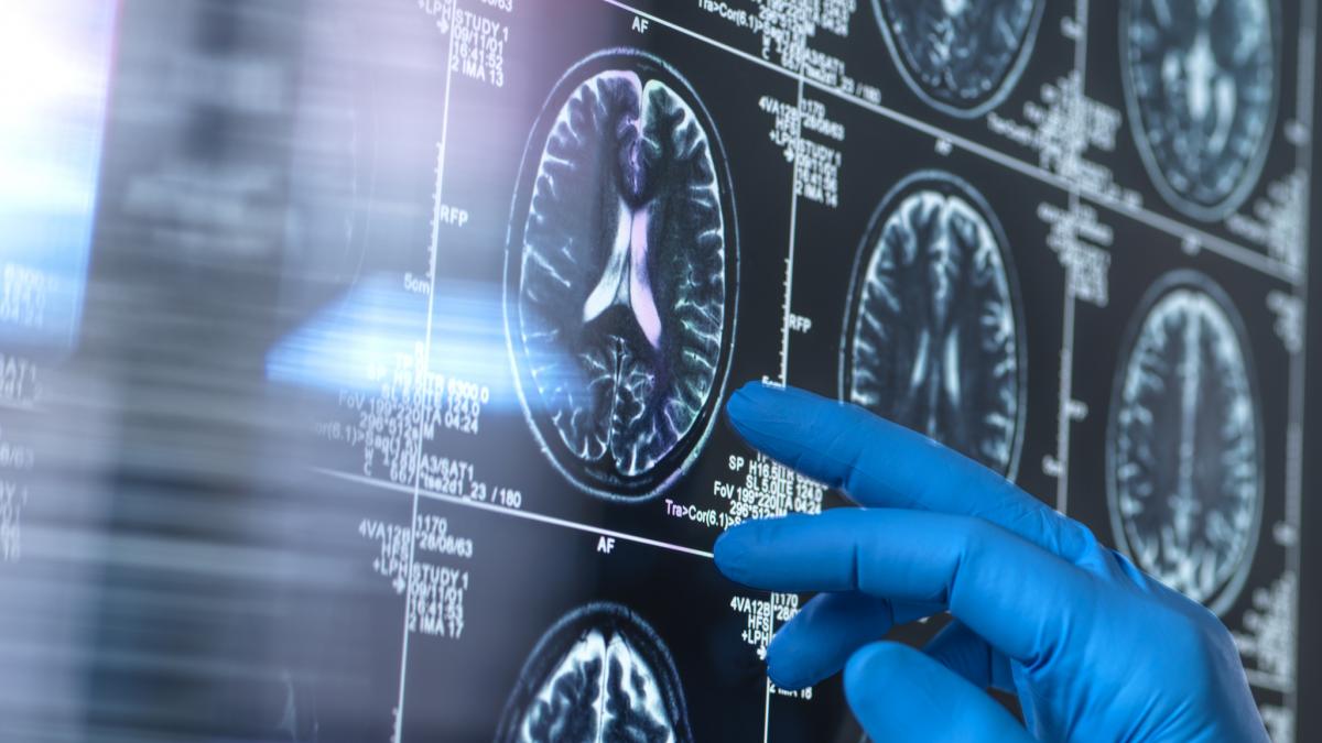 persoanele necasatorite au sanse mai mici sa dezvolte dementa care este explicatia