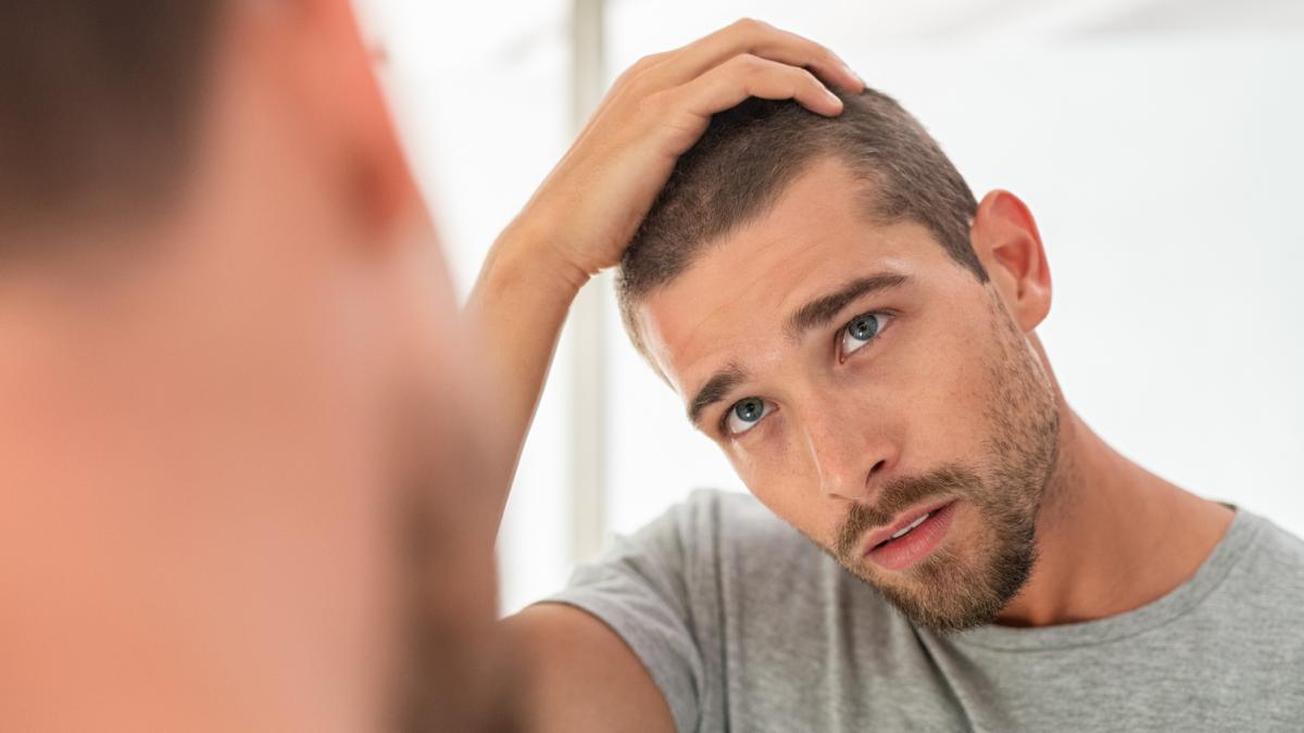 barbat ingrijorat alopecie calvitie chelie