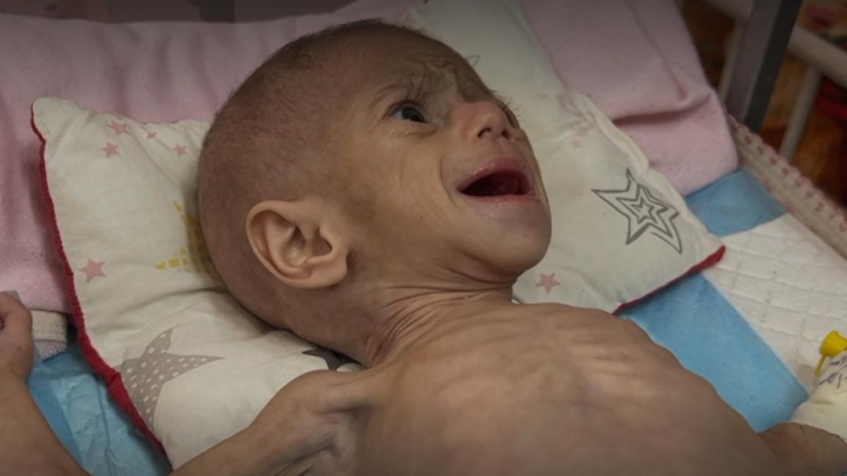 reportaj bbc un cameraman din fasia gaza s a intors in mijlocul conflictului sa afle soarta unei fetite e atat de slaba ca ma doare