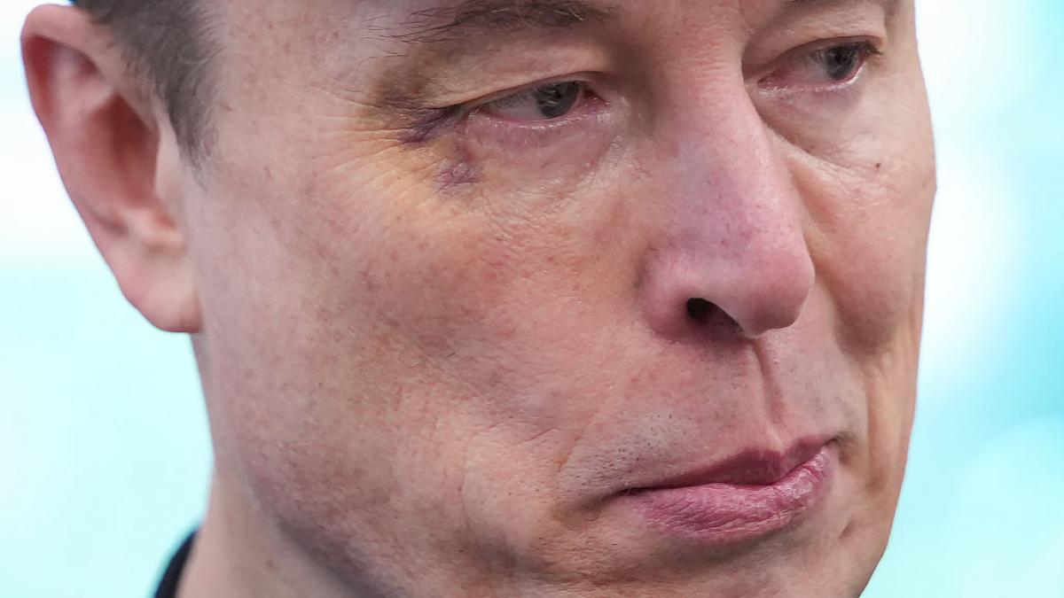 de ce a avut elon musk un ochi vanat la conferinta de presa cu donald trump